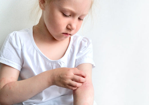 What Causes Eczema? These 5 Things